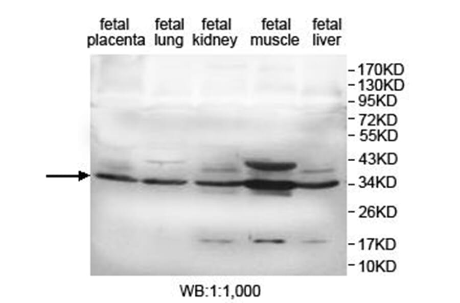 KDSR Antibody from Signalway Antibody (40019) - Antibodies.com