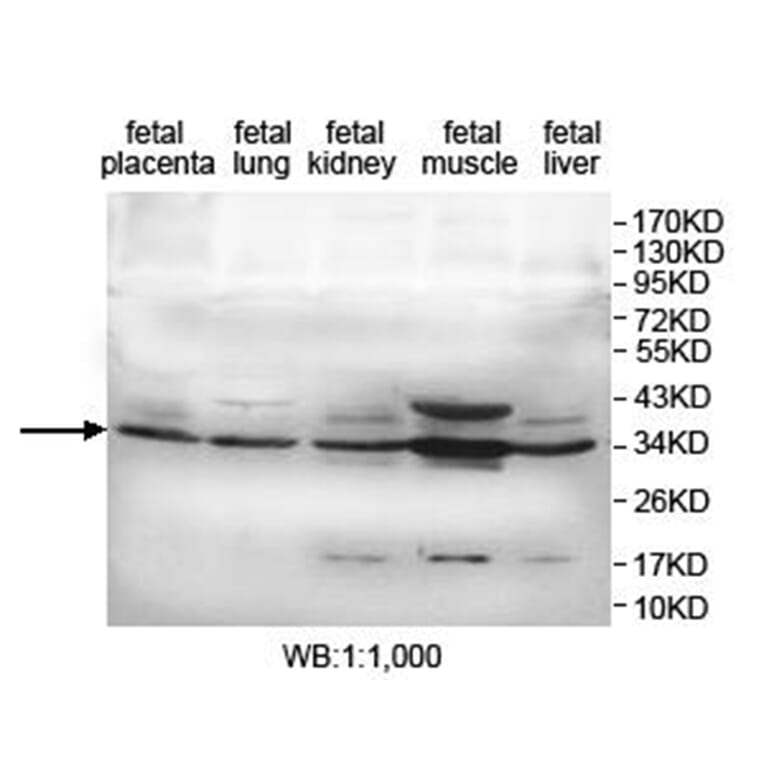 KDSR Antibody from Signalway Antibody (40019) - Antibodies.com