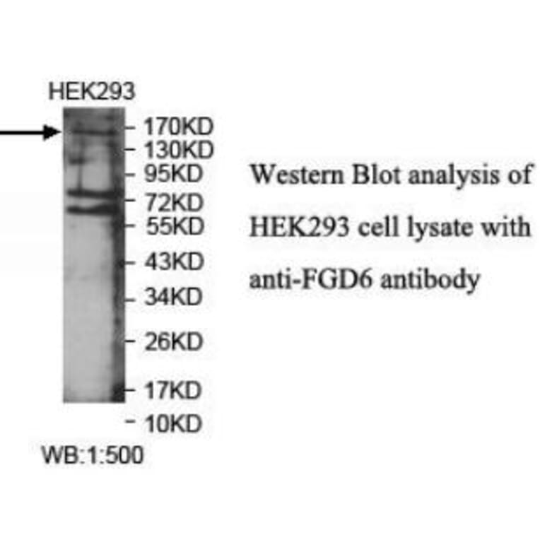 FGD6 Antibody from Signalway Antibody (40041) - Antibodies.com
