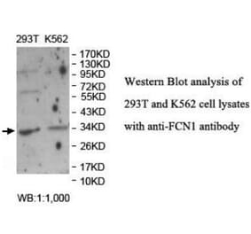 FCN1 Antibody from Signalway Antibody (40043) - Antibodies.com