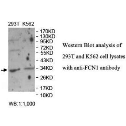 FCN1 Antibody from Signalway Antibody (40043) - Antibodies.com