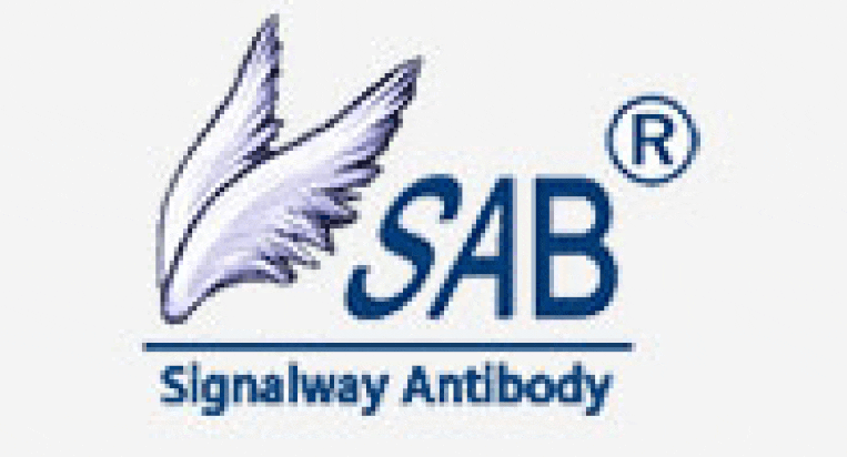 Hemagglutinin Monoclonal Antibody from Signalway Antibody (26018) - Antibodies.com