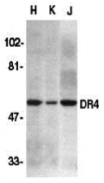 Western blot - DR4 Antibody from Signalway Antibody (24033) - Antibodies.com