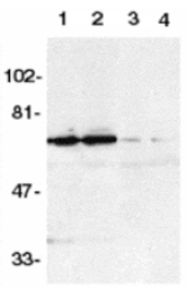 Western blot - DR6 Antibody from Signalway Antibody (24077) - Antibodies.com