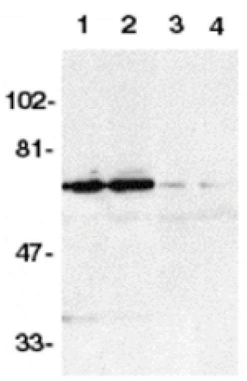 Western blot - DR6 Antibody from Signalway Antibody (24077) - Antibodies.com