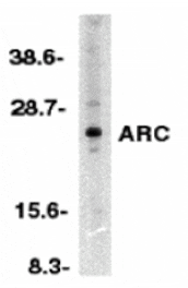 Western blot - ARC Antibody from Signalway Antibody (24081) - Antibodies.com