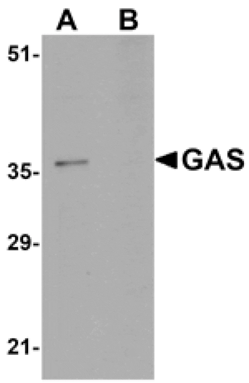 Western blot - GAS Antibody from Signalway Antibody (24983) - Antibodies.com