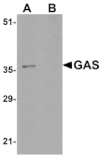Western blot - GAS Antibody from Signalway Antibody (24983) - Antibodies.com