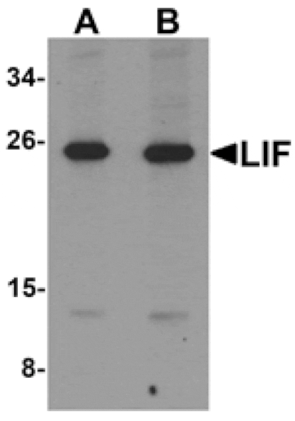Western blot - LIF Antibody from Signalway Antibody (25283) - Antibodies.com