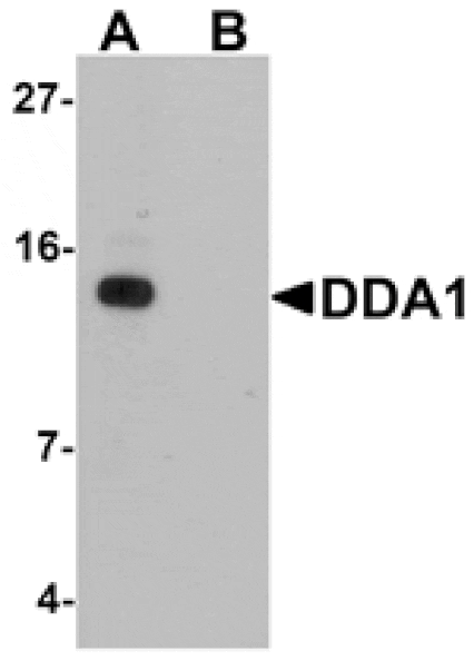 Western blot - DDA Antibody from Signalway Antibody (25354) - Antibodies.com