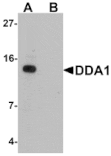 Western blot - DDA Antibody from Signalway Antibody (25354) - Antibodies.com