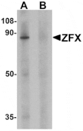 Western blot - ZFX Antibody from Signalway Antibody (25478) - Antibodies.com
