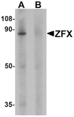 Western blot - ZFX Antibody from Signalway Antibody (25478) - Antibodies.com