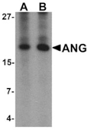 Western blot - ANG Antibody from Signalway Antibody (25522) - Antibodies.com