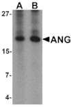 Western blot - ANG Antibody from Signalway Antibody (25522) - Antibodies.com
