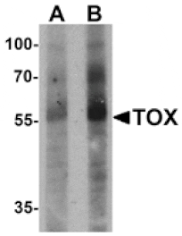 Western blot - TOX Antibody from Signalway Antibody (25524) - Antibodies.com