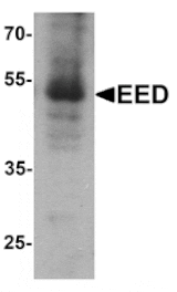 Western blot - EED Antibody from Signalway Antibody (25531) - Antibodies.com