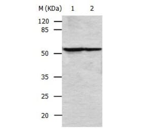 VIM Antibody from Signalway Antibody (31035) - Antibodies.com