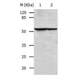 VIM Antibody from Signalway Antibody (31035) - Antibodies.com