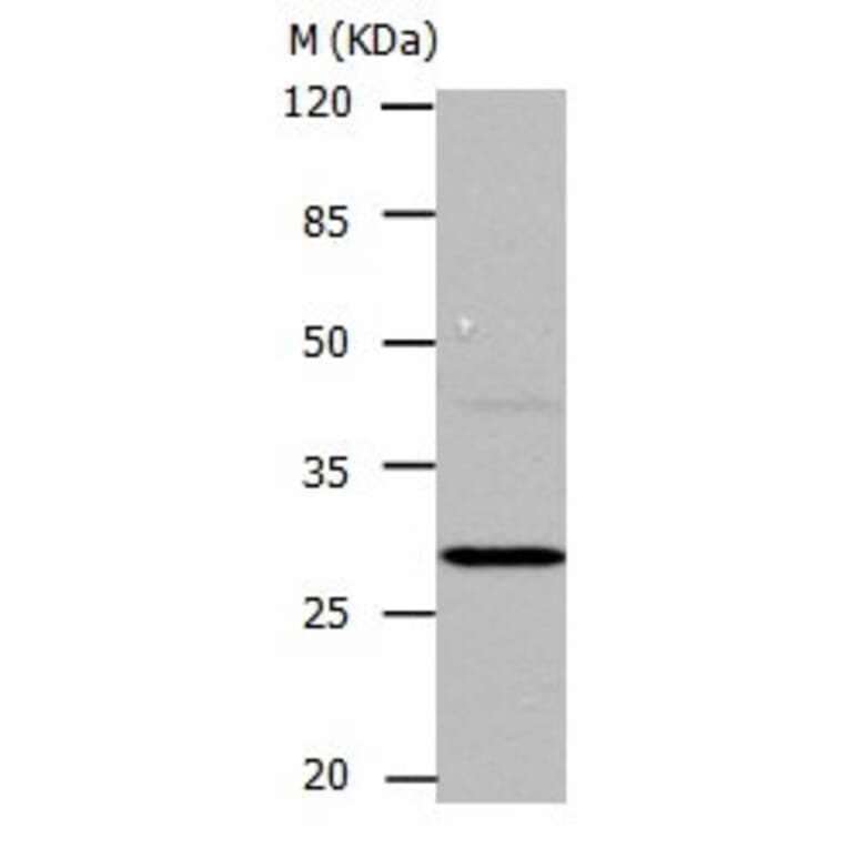 CA1 Antibody from Signalway Antibody (31043) - Antibodies.com