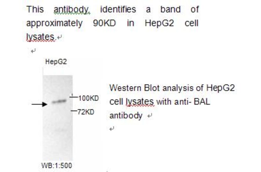BAL Antibody from Signalway Antibody (39218) - Antibodies.com