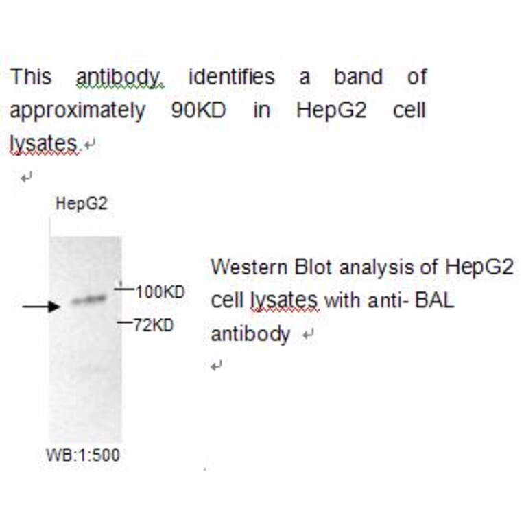 BAL Antibody from Signalway Antibody (39218) - Antibodies.com
