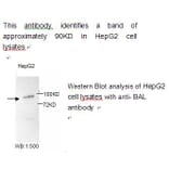 BAL Antibody from Signalway Antibody (39218) - Antibodies.com
