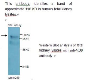 VDP Antibody from Signalway Antibody (39227) - Antibodies.com
