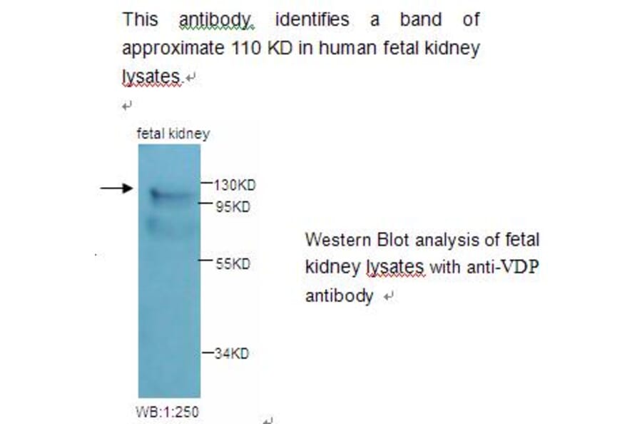 VDP Antibody from Signalway Antibody (39227) - Antibodies.com