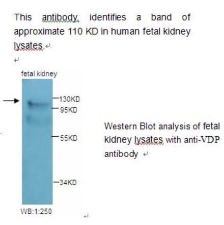 VDP Antibody from Signalway Antibody (39227) - Antibodies.com