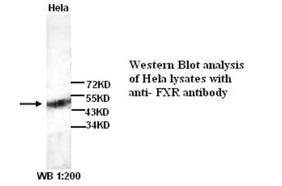FXR Antibody from Signalway Antibody (39259) - Antibodies.com