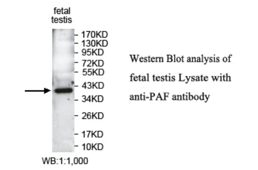PAF Antibody from Signalway Antibody (39745) - Antibodies.com