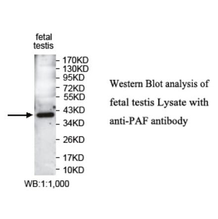 PAF Antibody from Signalway Antibody (39745) - Antibodies.com