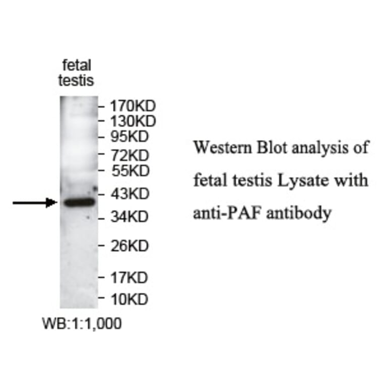 PAF Antibody from Signalway Antibody (39745) - Antibodies.com