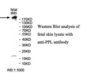 PPL Antibody from Signalway Antibody (39987) - Antibodies.com