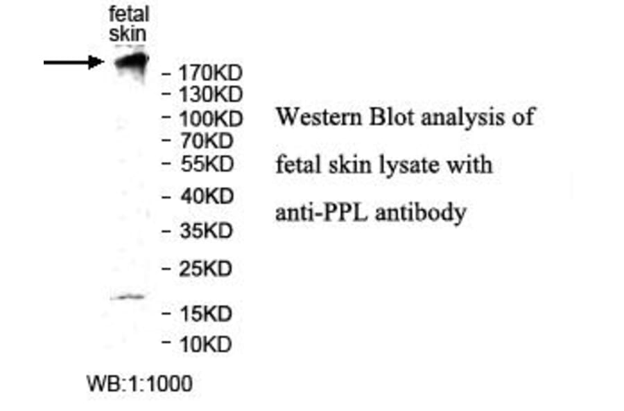 PPL Antibody from Signalway Antibody (39987) - Antibodies.com