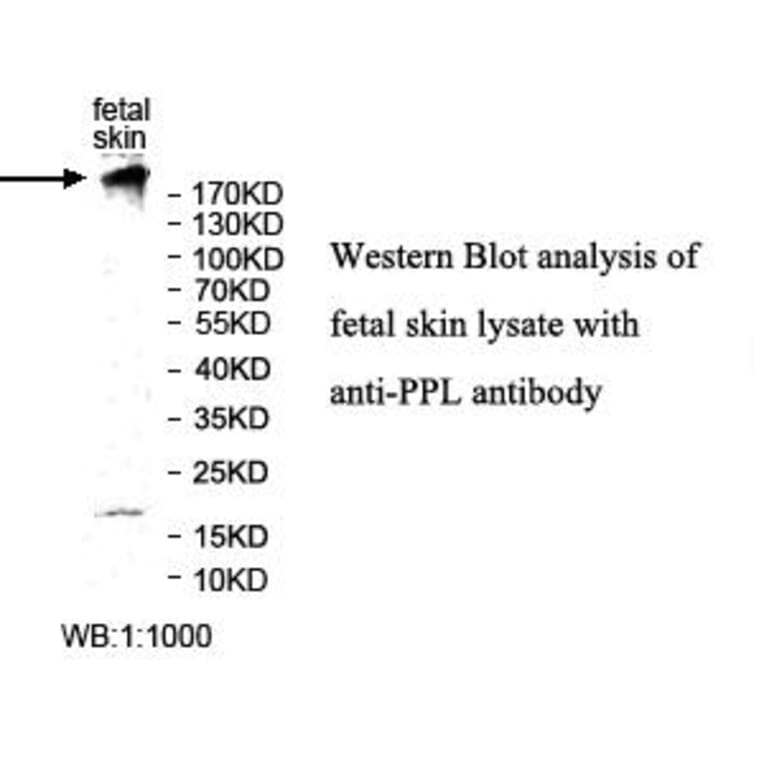 PPL Antibody from Signalway Antibody (39987) - Antibodies.com