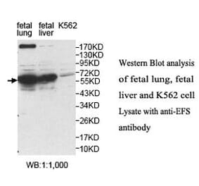 EFS Antibody from Signalway Antibody (40053) - Antibodies.com