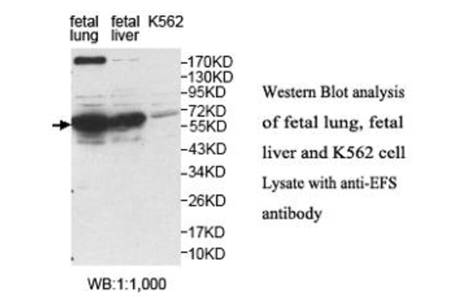 EFS Antibody from Signalway Antibody (40053) - Antibodies.com