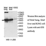 EFS Antibody from Signalway Antibody (40053) - Antibodies.com