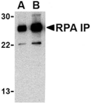 Western blot - RPA Interacting Protein Antibody from Signalway Antibody (24483) - Antibodies.com