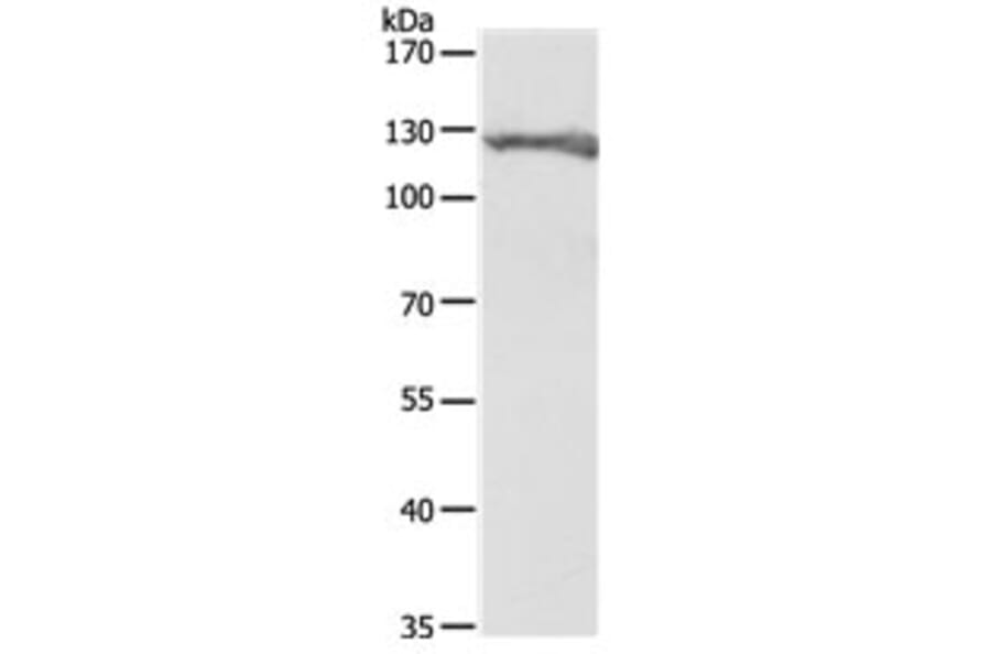 PC Antibody from Signalway Antibody (31111) - Antibodies.com