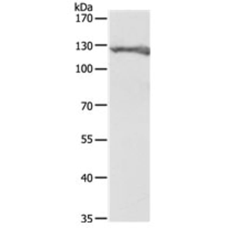 PC Antibody from Signalway Antibody (31111) - Antibodies.com