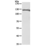 PC Antibody from Signalway Antibody (31111) - Antibodies.com
