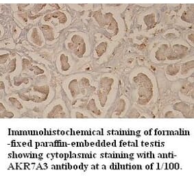 AKR7A3 Antibody from Signalway Antibody (39352) - Antibodies.com