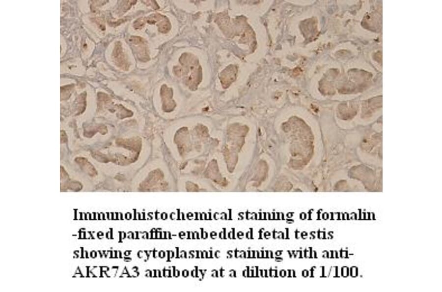 AKR7A3 Antibody from Signalway Antibody (39352) - Antibodies.com