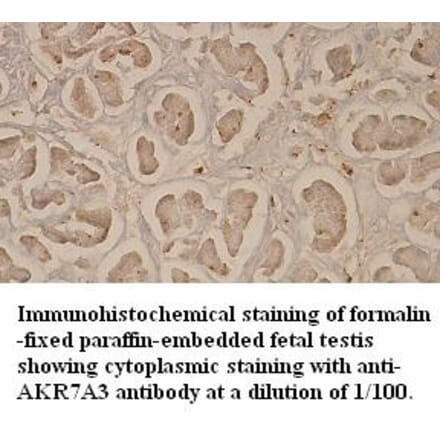 AKR7A3 Antibody from Signalway Antibody (39352) - Antibodies.com