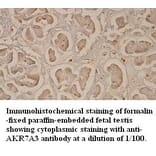 AKR7A3 Antibody from Signalway Antibody (39352) - Antibodies.com