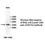 AKR7A3 Antibody from Signalway Antibody (39352) - Antibodies.com