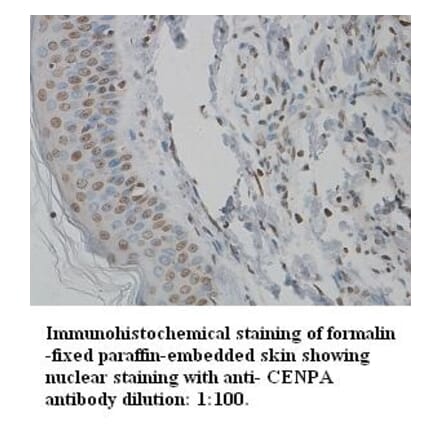 CENPA Antibody from Signalway Antibody (39344) - Antibodies.com
